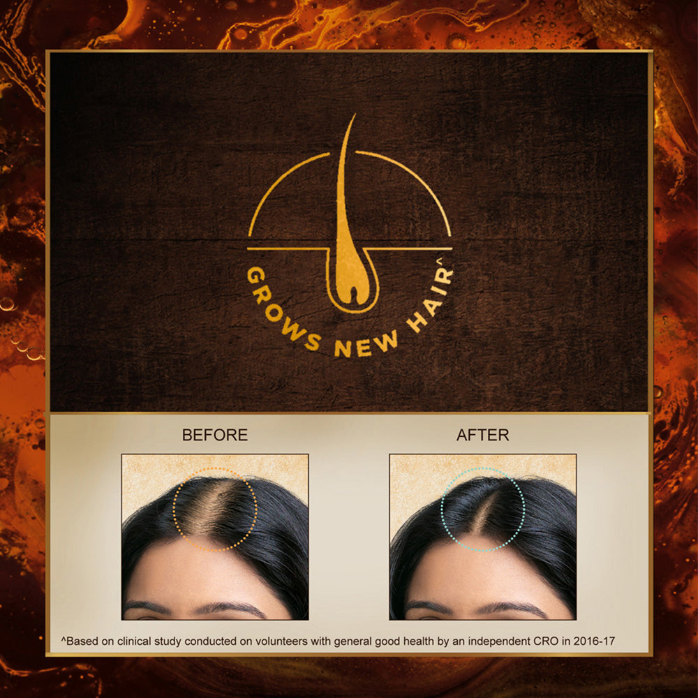 250ml , Bringha Hair Oil | Indulekha