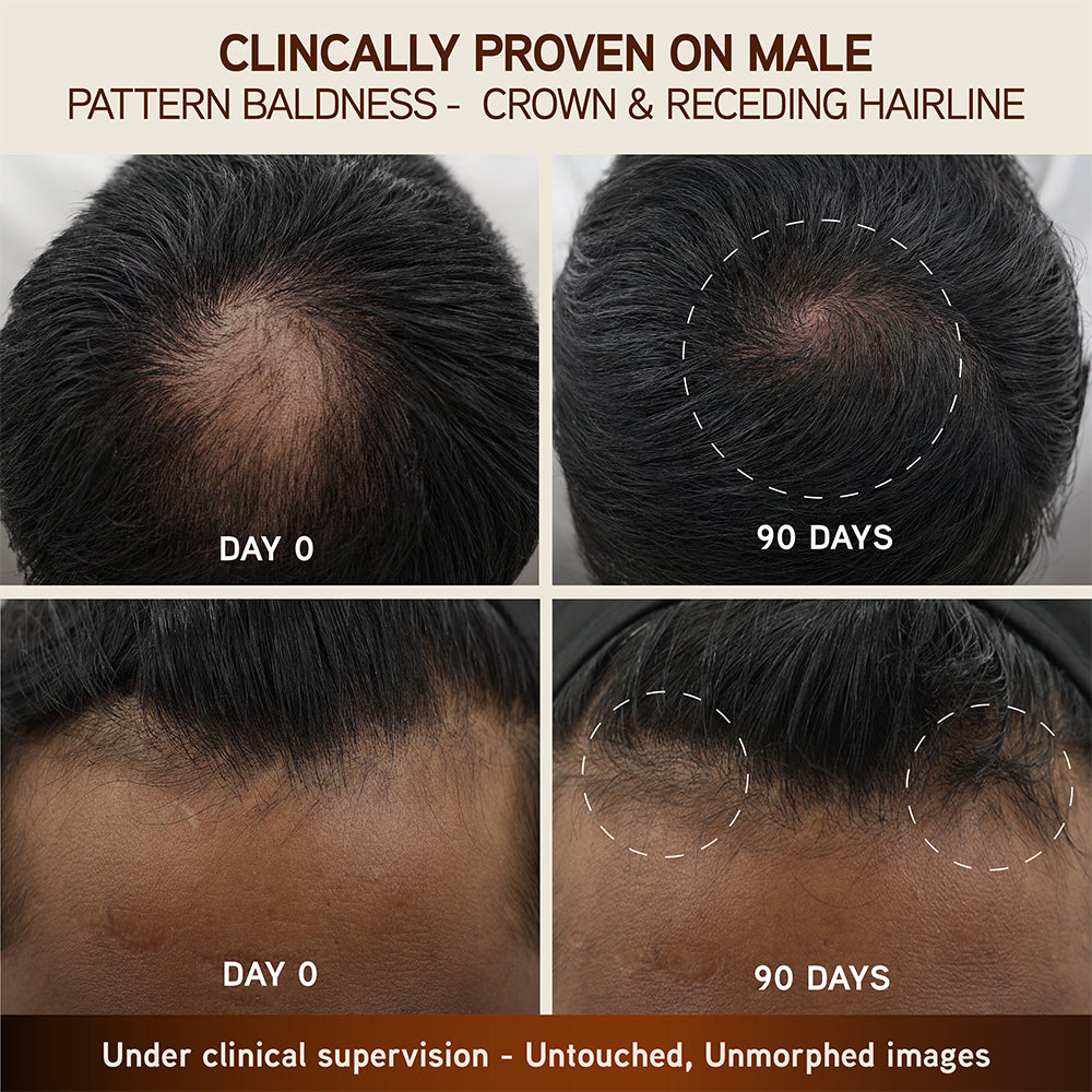 Indulekha Bringha Hair Growth Treatment Scalp Serum,30ml
