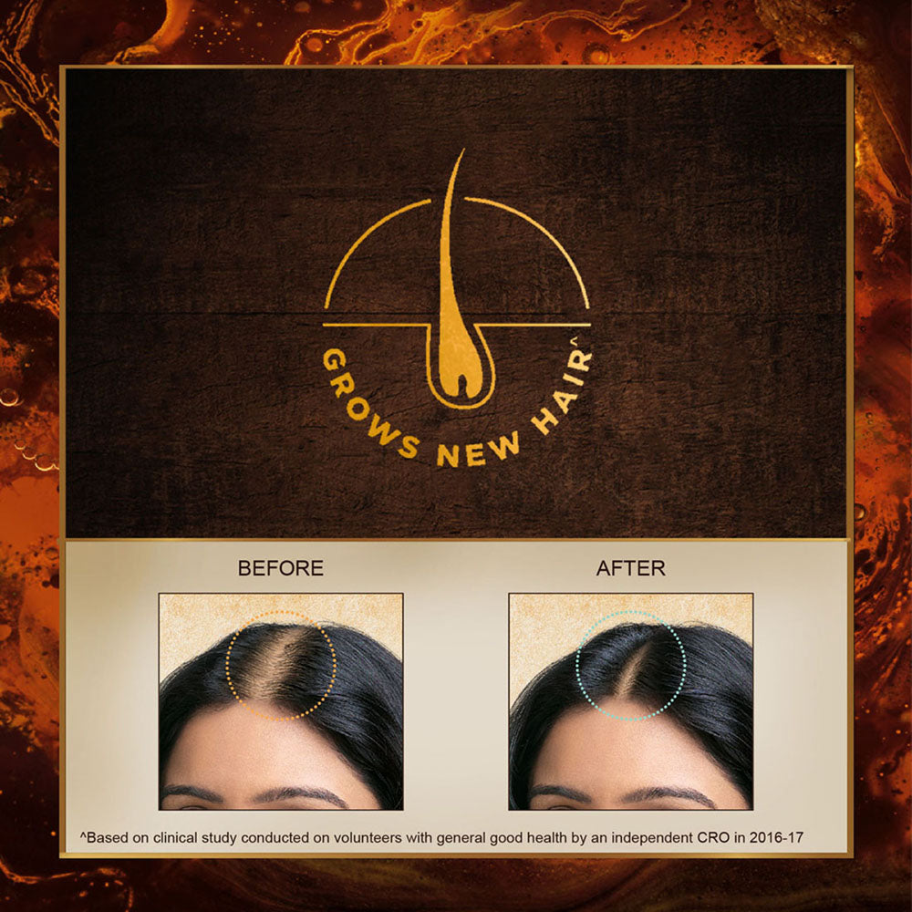 50ml , Bringha Hair Oil | Indulekha