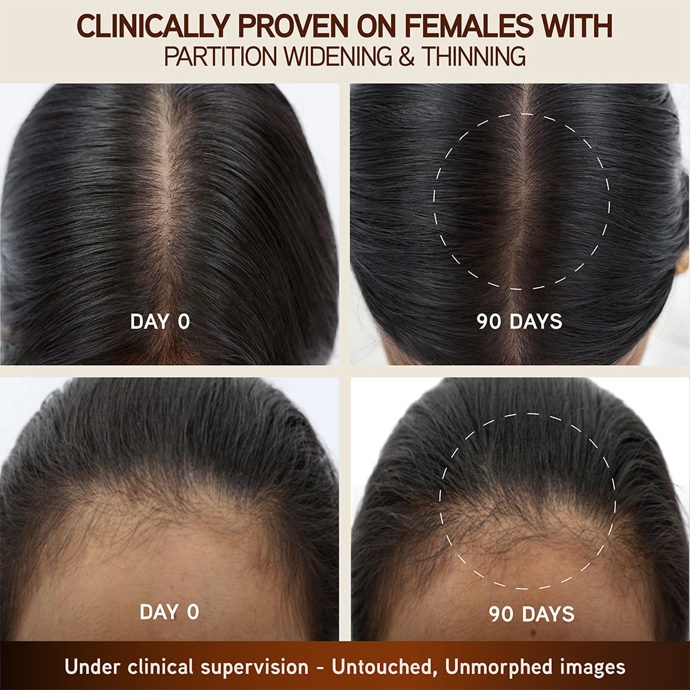 Indulekha Bringha Hair Growth Treatment Scalp Serum,30ml