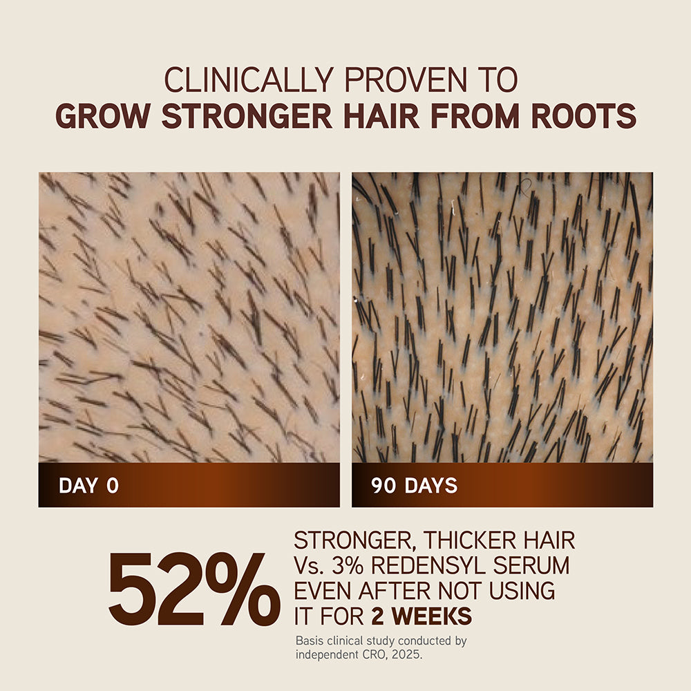 Indulekha Bringha Hair Growth Treatment Scalp Serum,30ml